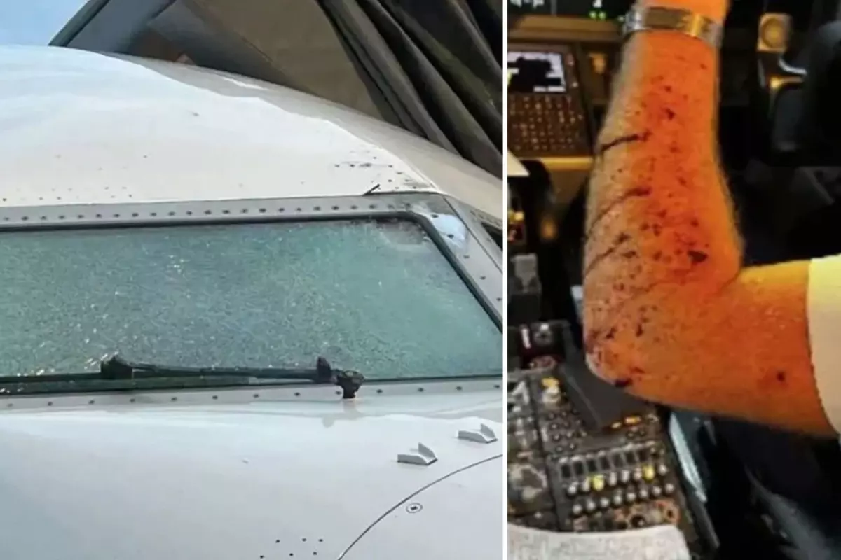 Yolcu Uçağına Meteor Çarptı, Pilot Yaralandı